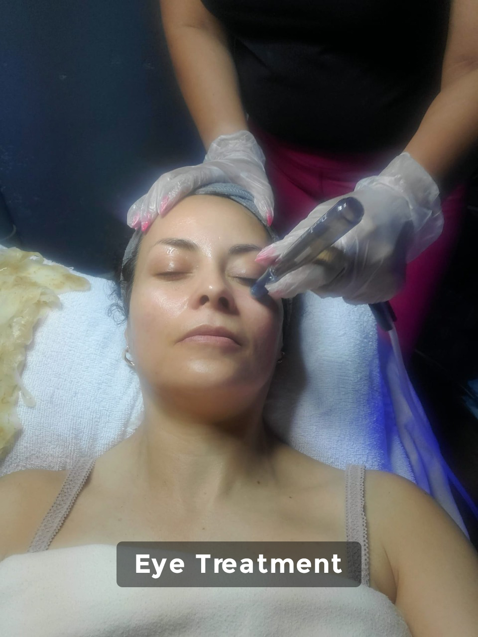 Cras tristique purus non lacus